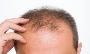 Masaža za jačanje slabog korena kose i bolji rast