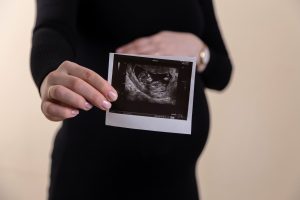 Praćenje fetalnog razvoja: Kako znati da li je sa vašom bebom sve u redu?